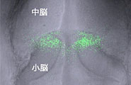 Light micrograph of the brain of a zebrafish embryo that expresses a flourescent protein on the border between the mesencephalon and the cerebellum.